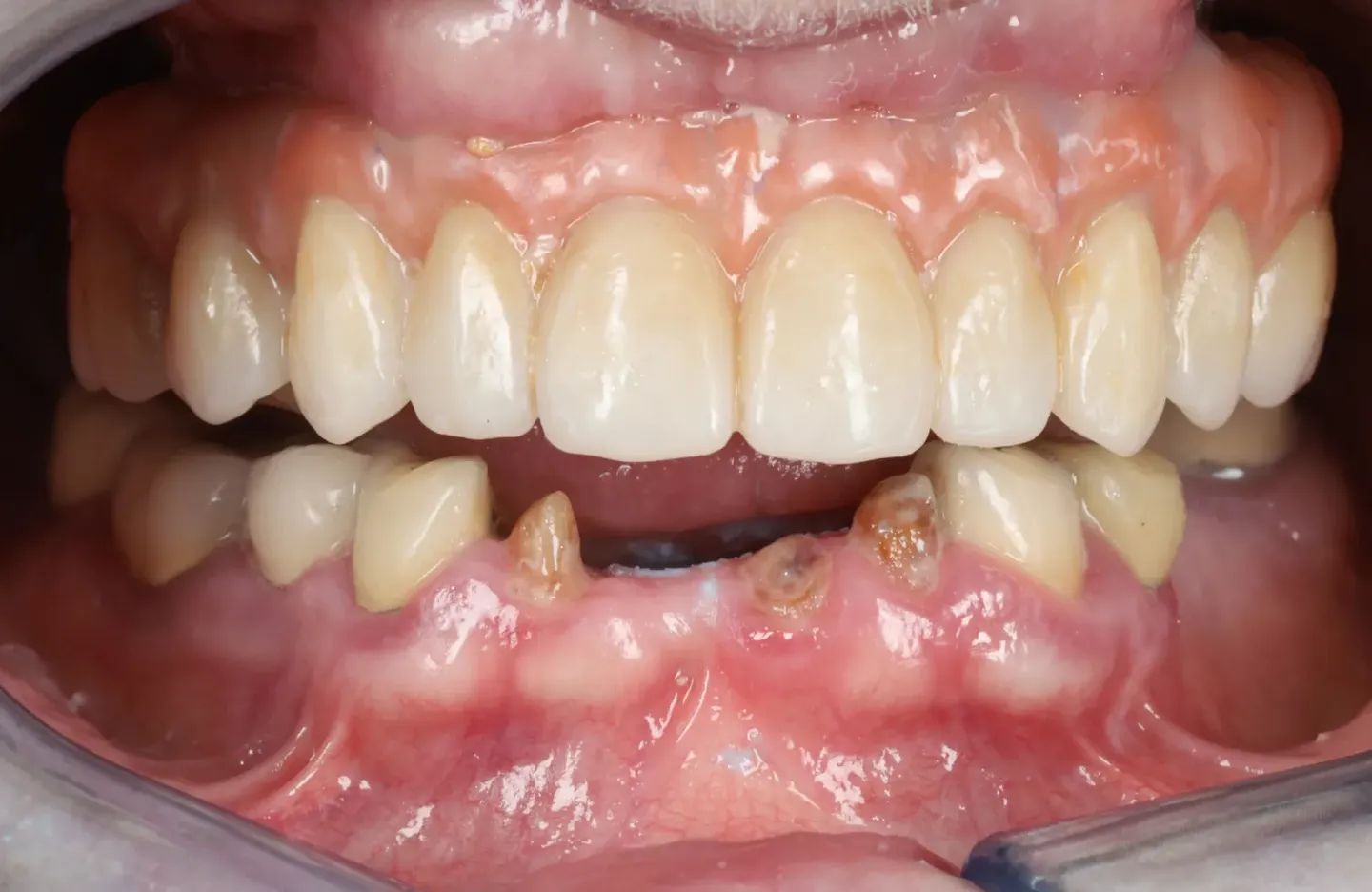8_Before